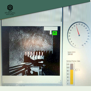 سیستم پایش شکستگی ناخن شاول